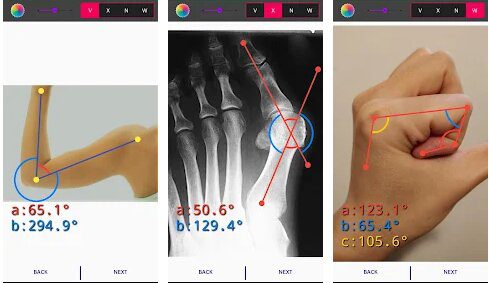 Angulus: Measure angles on images/videos