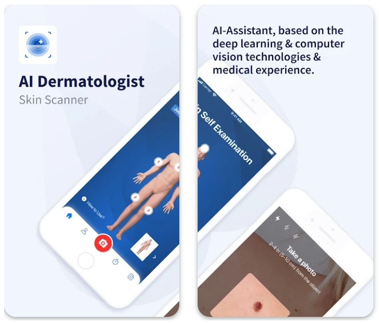 AI Dermatologist: Skin Scanner1